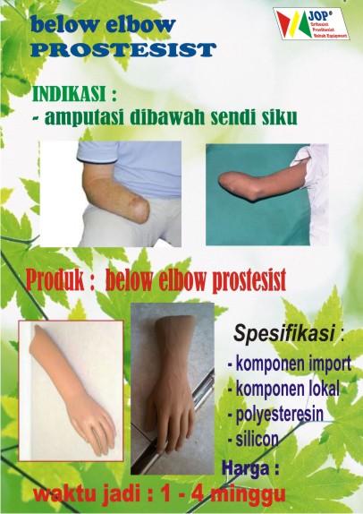 tangan palsu