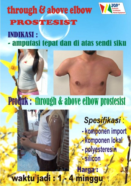tangan palsu